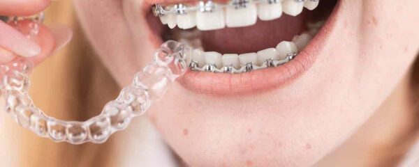 orthodontie