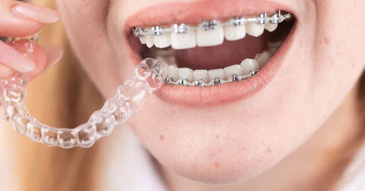 orthodontie